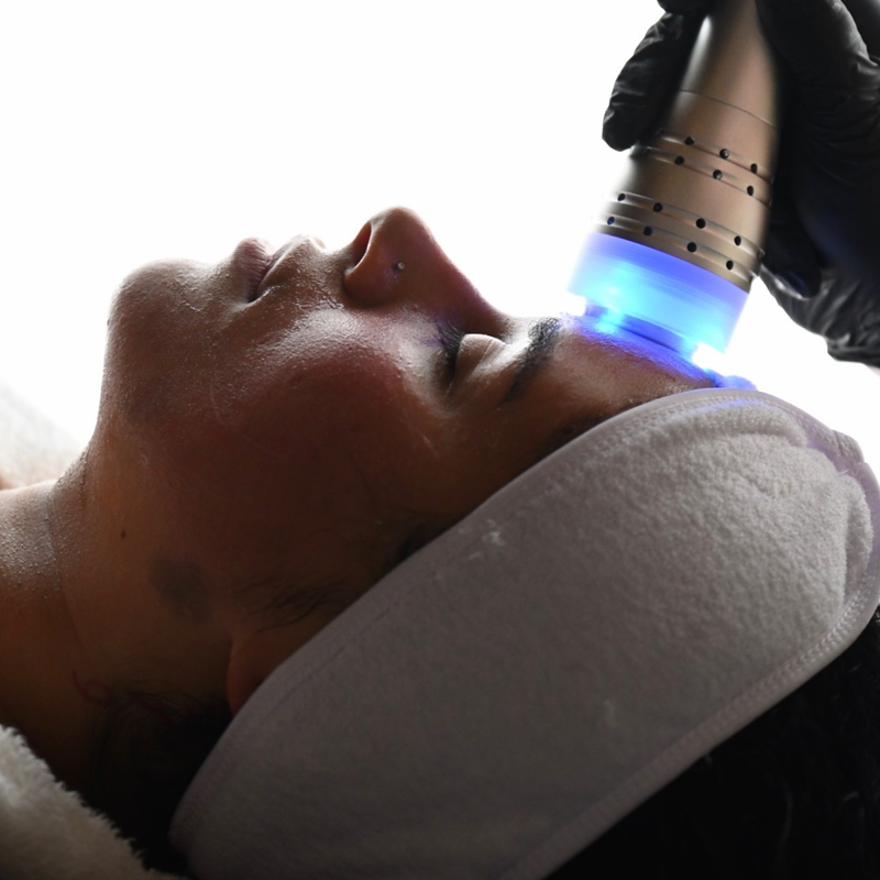 HYDROFACIAL