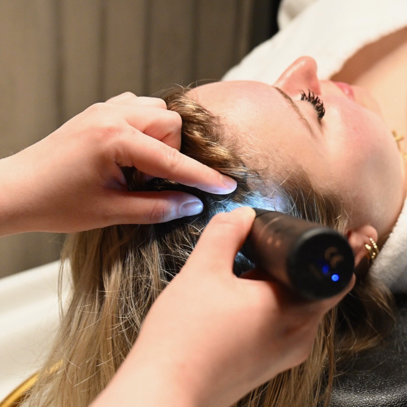 CONSULT + SCALP